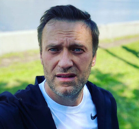 У Алексея Навального начался отек мозга