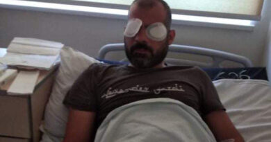 Оператор Общественного вещателя Грузии получил травму глаз