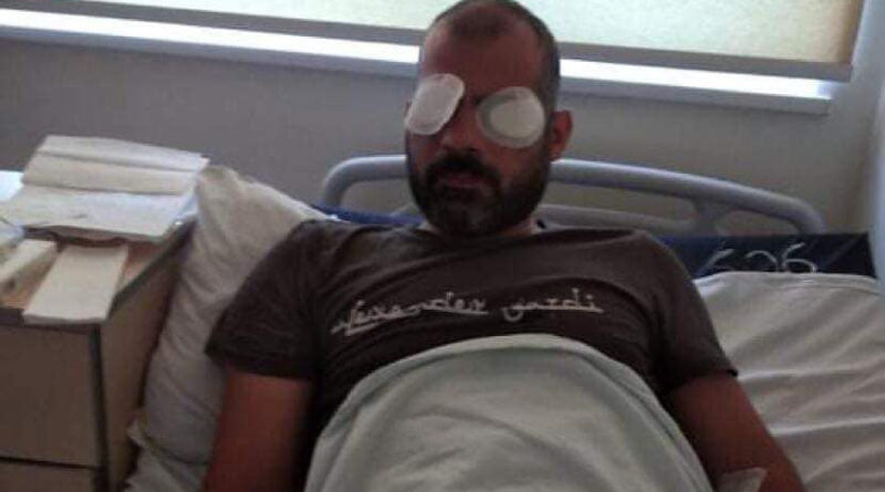 Оператор Общественного вещателя Грузии получил травму глаз