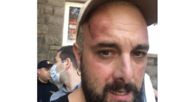 Журналисту «Радио Свобода» выбили зубы, избит оператор