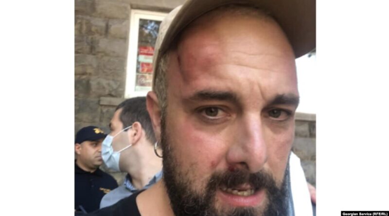 Журналисту «Радио Свобода» выбили зубы, избит оператор