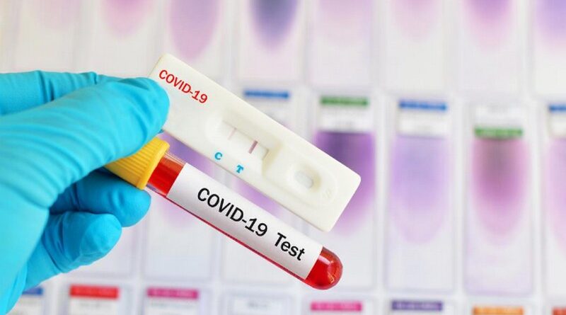10 ноября: В Грузии выявлен 5751 новый случай коронавируса