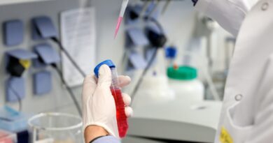 19 марта: В Грузии зафиксировано 849 новых случаев коронавируса