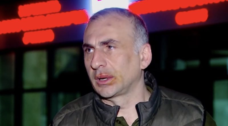 Депутат Элисашвили заявил, что полицейские сломали ему ребро