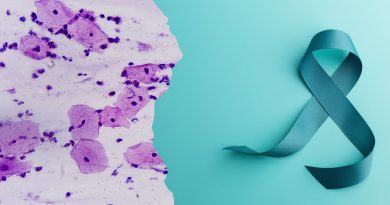 Улучшение диагностики: что меняется в программе скрининга рака шейки матки