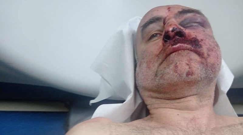 Задержанный лидер «Антиоккупационного движения» Давид Кацарава сильно избит